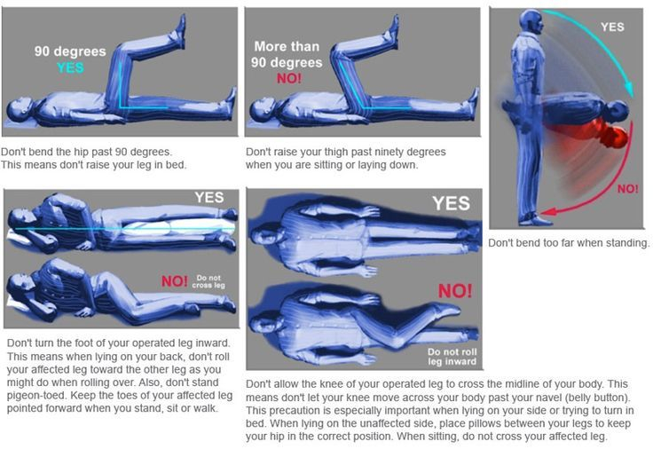 Hip Precautions For After Surgery Until Your Doctor Says That s