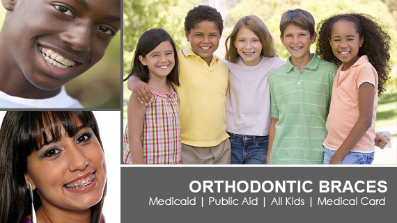 Public Aid Covers Braces For Children In Illinois Public Aid Orthodontics