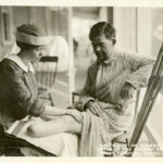 Stump Massage For Amputee Reeve 000287 National Museum Flickr